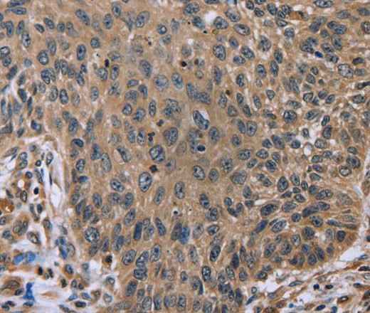 Anti-Human/Mouse EDA Antibody