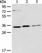 Western blot analysis of 293T Hela and A431 cell lysates using MORF4L2 Polyclonal Antibody at dilution of 1:500