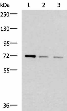 Western blot analysis of K562 HepG2 and Jurkat cell lysates using FOXK1 Polyclonal Antibody at dilution of 1:400