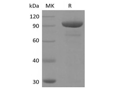 Recombinant Human 5'-Nucleotidase/5'-NT/CD73 (AAH65937.1, C-Fc) - ABMIUM