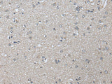 Immunohistochemistry of paraffin-embedded Human brain tissue using PRAME Polyclonal Antibody at dilution of 1:65(×200)