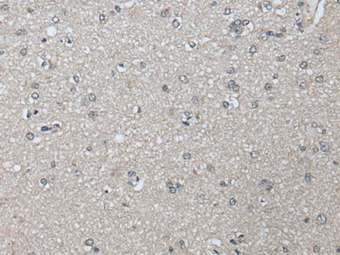 Immunohistochemistry of paraffin-embedded Human brain tissue using PRAME Polyclonal Antibody at dilution of 1:65(×200)