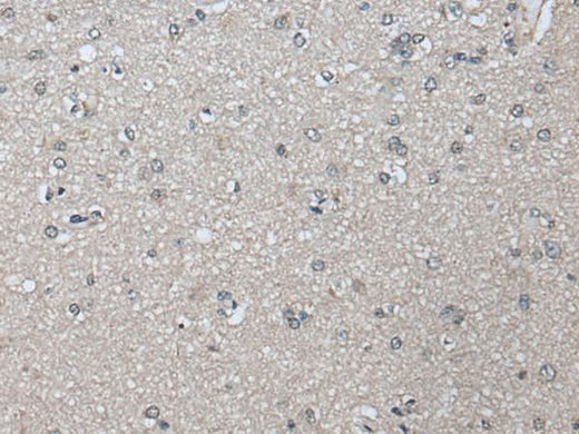 Immunohistochemistry of paraffin-embedded Human brain tissue using PRAME Polyclonal Antibody at dilution of 1:65(×200)