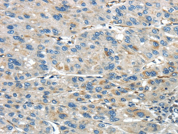 Anti-Human/Mouse IQGAP2 Antibody - ABMIUM