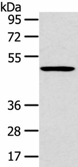 Western blot analysis of 231 cell using HTRA1 Polyclonal Antibody at dilution of 1:500