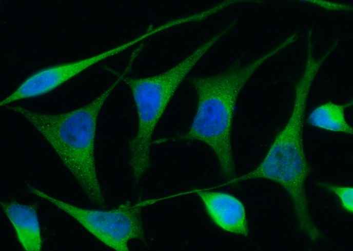 Anti-Human REN Antibody [B279] - ABMIUM