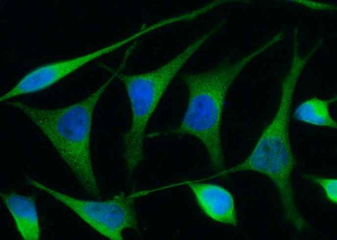 Anti-Human REN Antibody [B279] - ABMIUM