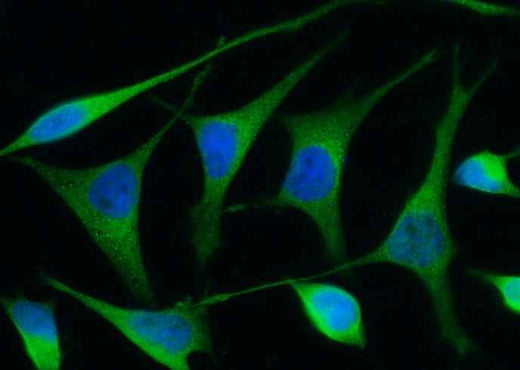 Anti-Human REN Antibody [B279] - ABMIUM