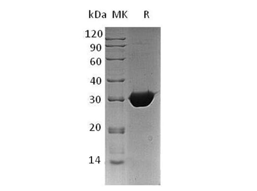 Recombinant Human BPGM Protein (His Tag) - ABMIUM