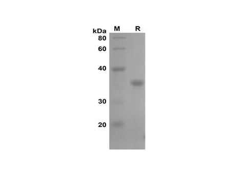 SDS-PAGE analysis of Mouse TNF-α proteins, 2 μg/lane of Recombinant Mouse TNF-α proteins was resolved with SDS-PAGE under reducing conditions, showing bands at 37 kDa.