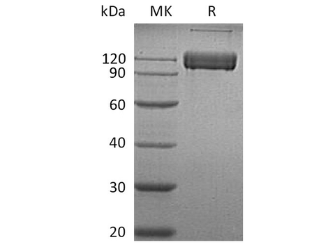 Recombinant Human ALCAM/CD166 Protein (Fc Tag) - ABMIUM