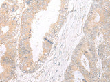 Anti-Human HLA-C Antibody - ABMIUM