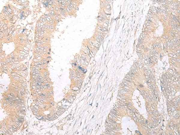 Anti-Human HLA-C Antibody