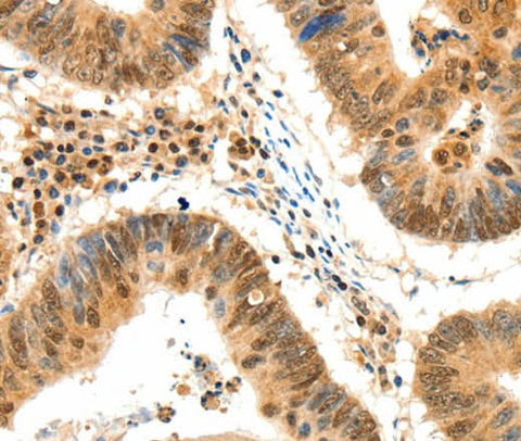 Anti-Human TERF2 Antibody - ABMIUM