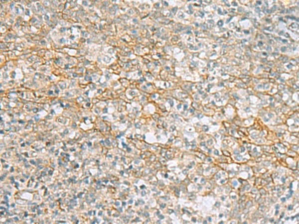 Immunohistochemistry of paraffin-embedded Human tonsil tissue using KCNH7 Polyclonal Antibody at dilution of 1:60(×200)