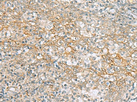 Immunohistochemistry of paraffin-embedded Human tonsil tissue using KCNH7 Polyclonal Antibody at dilution of 1:60(×200)
