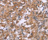Anti-Human/Mouse/Rat GNPAT Antibody - ABMIUM