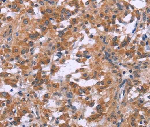 Anti-Human/Mouse/Rat GNPAT Antibody