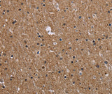 Anti-Human CMTM5 Antibody - ABMIUM
