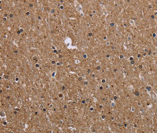 Anti-Human CMTM5 Antibody - ABMIUM