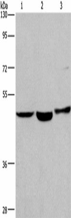 Western blot analysis of Human placenta tissue Human fetal liver tissue 231 cells using APMAP Polyclonal Antibody at dilution of 1:400