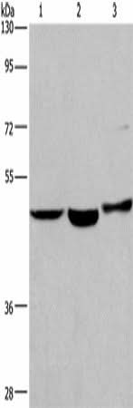Western blot analysis of Human placenta tissue Human fetal liver tissue 231 cells using APMAP Polyclonal Antibody at dilution of 1:400