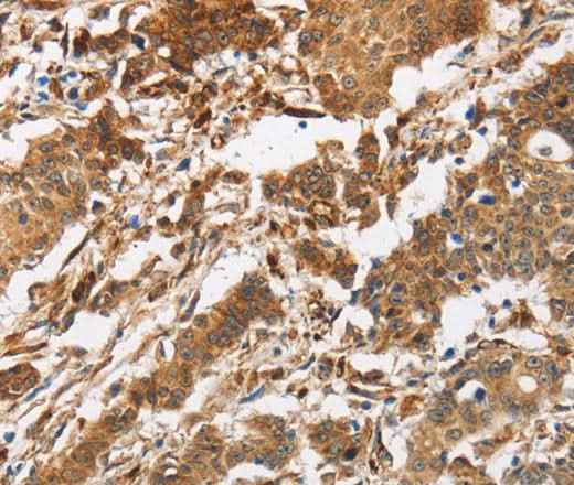 Anti-Human/Mouse/Rat CALU Antibody