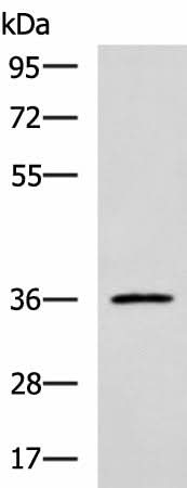 Western blot analysis of Jurkat cell lysate using IBSP Polyclonal Antibody at dilution of 1:700