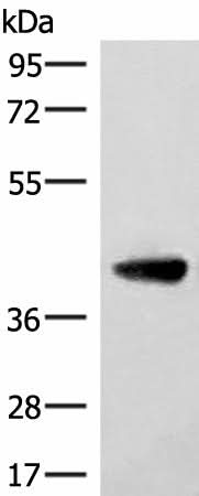 Western blot analysis of Human cerebella tissue lysate using ST8SIA4 Polyclonal Antibody at dilution of 1:350