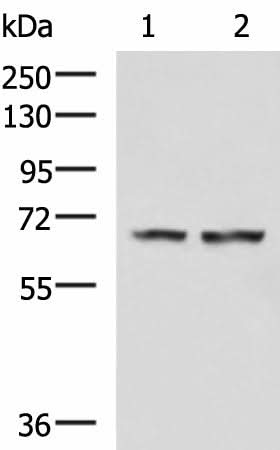 Western blot analysis of Human cerebella tissue Human cerebrum tissue lysates using FNBP1L Polyclonal Antibody at dilution of 1:750