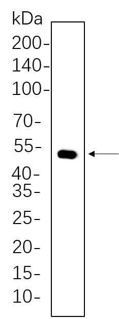 Anti-Human/Mouse/Rat Cytokeratin 14 Antibody [B672] - ABMIUM