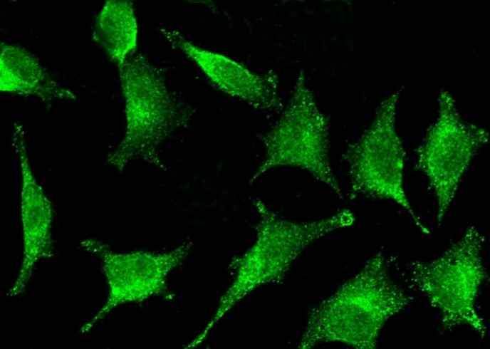 Anti-Human IFI30 Antibody [B177] - ABMIUM