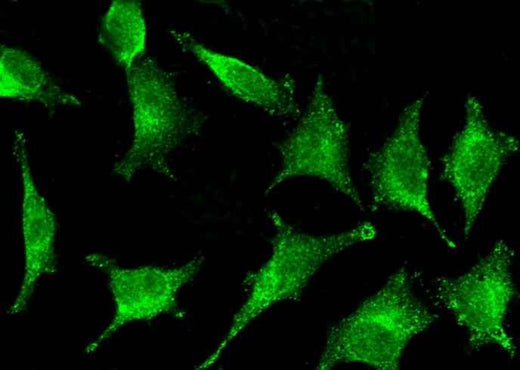 Anti-Human IFI30 Antibody [B177] - ABMIUM