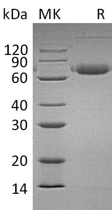 Recombinant Mouse B7-DC/PD-L2/CD273 Protein (Fc Tag) - ABMIUM