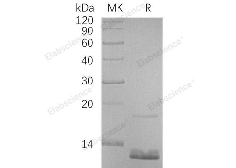 Recombinant Human CCL18 Protein (His Tag) - ABMIUM