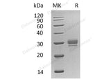 Recombinant Human CTHRC1 Protein (His Tag) - ABMIUM