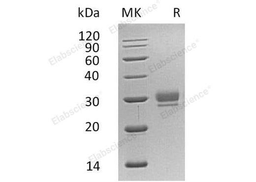 Recombinant Human CTHRC1 Protein (His Tag) - ABMIUM