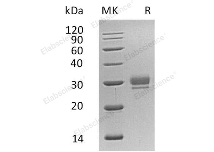 Recombinant Human CTHRC1 Protein (His Tag) - ABMIUM