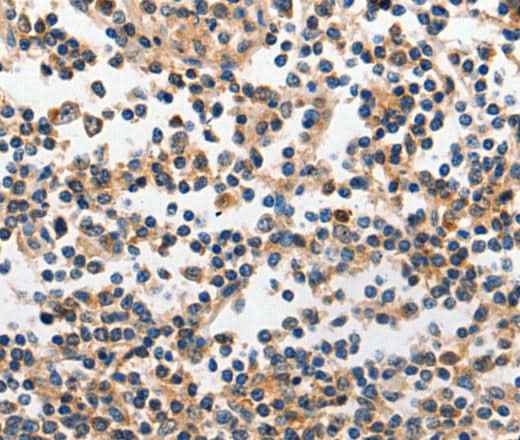 Anti-Human/Mouse/Rat INHA Antibody