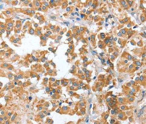Anti-Human CIAPIN1 Antibody