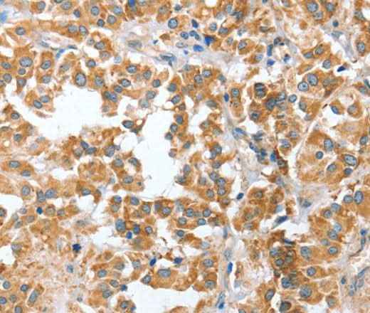 Anti-Human CIAPIN1 Antibody