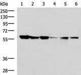 Western blot analysis of 293T 231 K562 Jurkat and Hela cell lysates using FKBP4 Polyclonal Antibody at dilution of 1:700