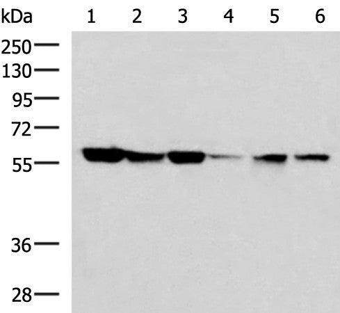 Western blot analysis of 293T 231 K562 Jurkat and Hela cell lysates using FKBP4 Polyclonal Antibody at dilution of 1:700