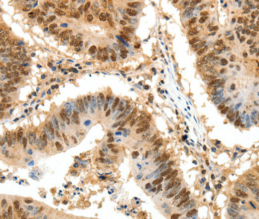 Anti-Human/Mouse/Rat SSB Antibody - ABMIUM