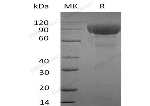 Recombinant Human IL-1RL2 Protein (Fc Tag) - ABMIUM