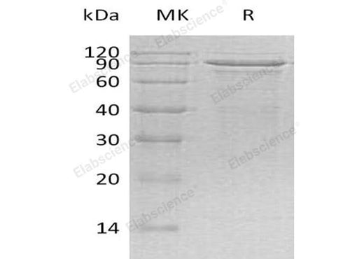 Recombinant Human MECP2 Protein (His Tag) - ABMIUM