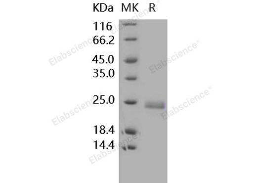 Recombinant Human TNFSF14/LIGHT Protein (His Tag) - ABMIUM