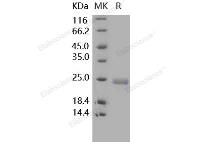 Recombinant Human TNFSF14/LIGHT Protein (His Tag) - ABMIUM