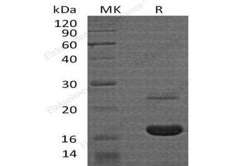 Recombinant Human MYDGF Protein (His Tag) - ABMIUM