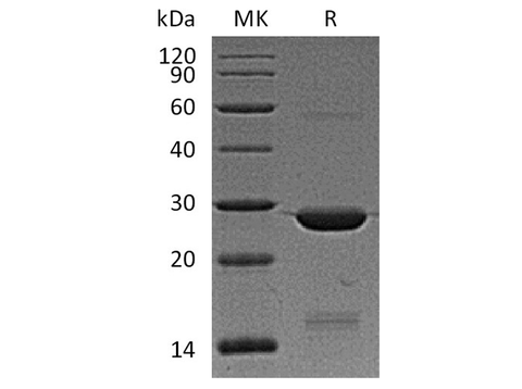Recombinant Human BAG2 Protein (His Tag) - ABMIUM